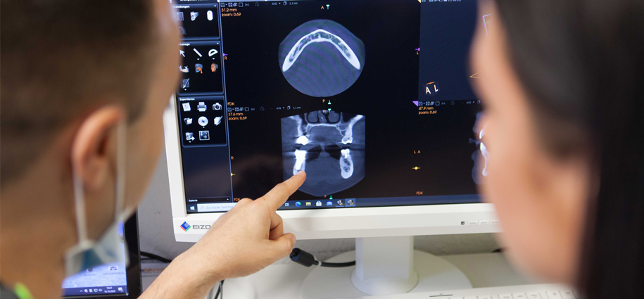 Digitales 3D-Röntgen (DVT)